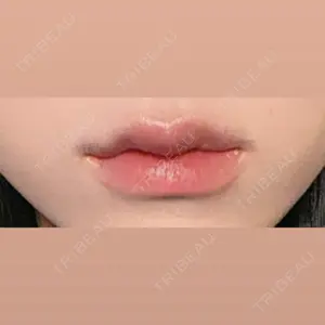 ルラ美容クリニック ルラ美容クリニック 大阪本院口コミ