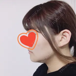 RG整形外科（旧リオン整形外科）口コミ