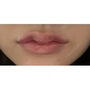 口コミ