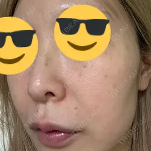 東京シルククリニック 東京シルククリニック 新宿院口コミ