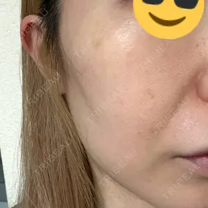 東京シルククリニック 東京シルククリニック 新宿院口コミ