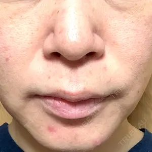 東京シルククリニック 東京シルククリニック 新宿院口コミ