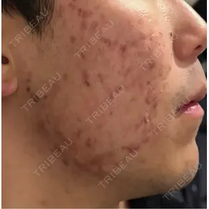 ルラ美容クリニック ルラ美容クリニック 広島院口コミ