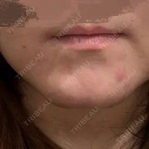 東京形成美容外科 東京形成美容外科 船橋院口コミ