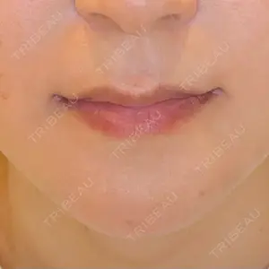 LOUIS CLINIC 二子玉川院【ルイクリニック】口コミ