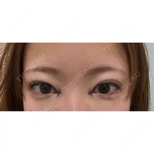 R Beauty CLINIC R Beauty CLINIC 大阪院口コミ