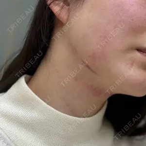 Belle Via Skin Clinic Belle Via Clinic口コミ