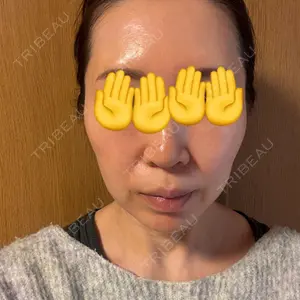 新宿Ladies&Gentlemen美容クリニック口コミ