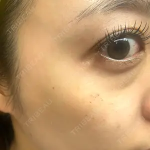 東京シルククリニック 東京シルククリニック 新宿院口コミ