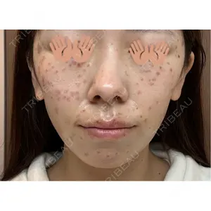 東京シルククリニック 東京シルククリニック 東京神田院口コミ