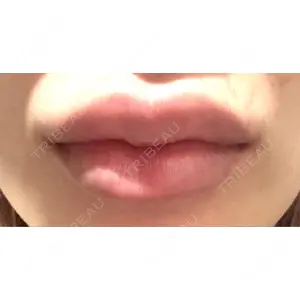 L‘amour clinic Tokyo【ラムールクリニック東京】口コミ