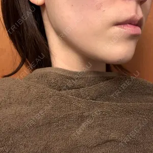 TCB東京中央美容外科 TCB東京中央美容外科 広島院口コミ