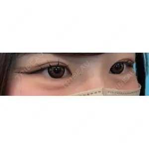 ルラ美容クリニック ルラ美容クリニック 渋谷本院口コミ