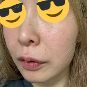 東京シルククリニック 東京シルククリニック 新宿院口コミ