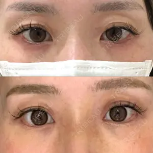 アイビークリニック 千葉美容外科アイビークリニック口コミ