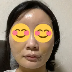 口コミ