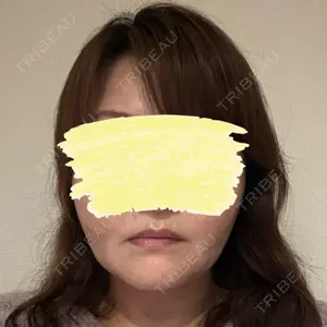 ゆきスキンクリニック 東池袋口コミ