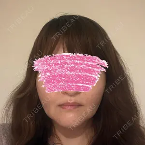 ゆきスキンクリニック 東池袋口コミ