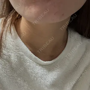 日本美容・医療クリニック 日本美容・医療クリニック 六本木院口コミ