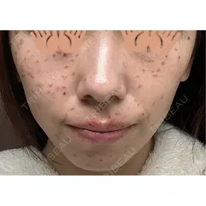 東京シルククリニック 東京シルククリニック 東京神田院口コミ