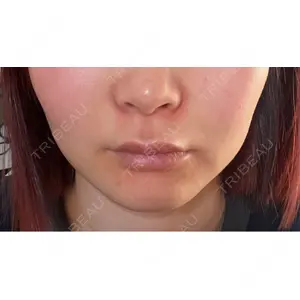 HINATA クリニック口コミ