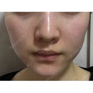 Belle Via Skin Clinic Belle Via Clinic口コミ