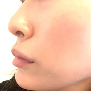 口コミ