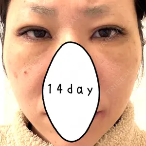 アリエル美容クリニック アリエル美容クリニック 水戸院口コミ