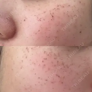 ルラ美容クリニック ルラ美容クリニック 札幌本院口コミ