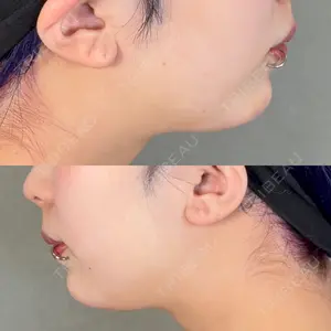 口コミ