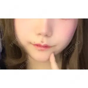 ビューティースキンクリニック ビューティースキンクリニック 池袋院口コミ