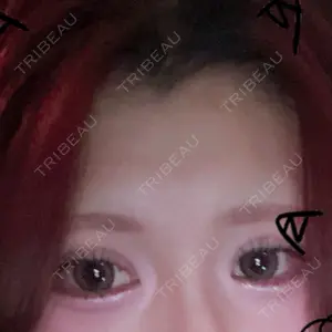 Belle Via Skin Clinic Belle Via Clinic口コミ