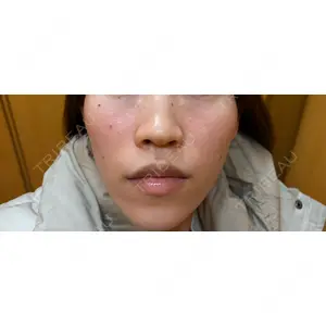 ビラビューティークリニック 博多美容外科/美容皮膚科 ビラビューティークリニック口コミ