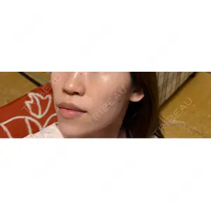 ビラビューティークリニック 博多美容外科/美容皮膚科 ビラビューティークリニック口コミ