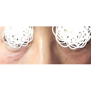 新宿Ladies&Gentlemen美容クリニック口コミ