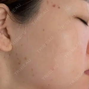 BISIN GINZA CLINIC口コミ