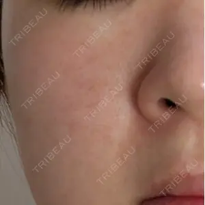 BISIN GINZA CLINIC口コミ