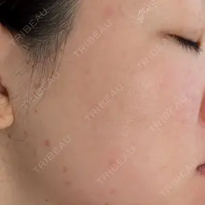 BISIN GINZA CLINIC口コミ