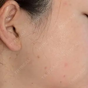 BISIN GINZA CLINIC口コミ