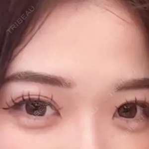 Belle Via Skin Clinic Belle Via Clinic口コミ