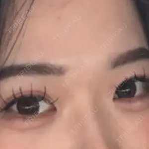 Belle Via Skin Clinic Belle Via Clinic口コミ