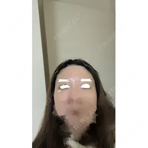 PRISM Beauty Clinic  PRISM Beauty Clinic 新宿院口コミ