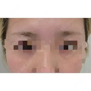 TCB東京中央美容外科 TCB東京中央美容外科 高崎院口コミ