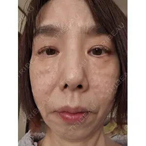 アイビークリニック 千葉美容外科アイビークリニック口コミ