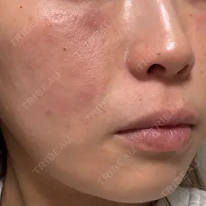 NARU Beauty Clinic NARU Beauty Clinic 【ナルクリ】 水戸院口コミ