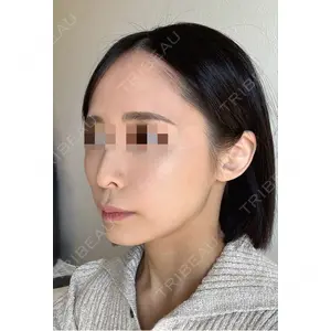 BLINC CLINIC （ブリンク クリニック）口コミ