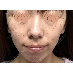 東京シルククリニック 東京シルククリニック 東京神田院口コミ