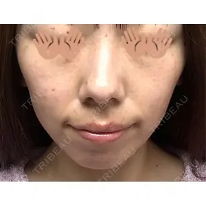 東京シルククリニック 東京シルククリニック 東京神田院口コミ