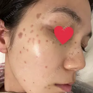 東京シルククリニック 東京シルククリニック 新宿院口コミ