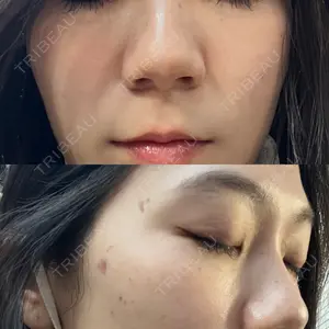 東京シルククリニック 東京シルククリニック 新宿院口コミ